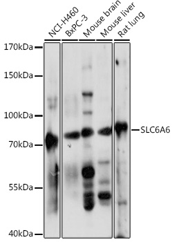 Western blot analysis of extracts of various cell lines using SLC6A6 Polyclonal Antibody at 1:1000 dilution.