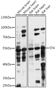 Western blot analysis of extracts of various cell lines using 5T4 Polyclonal Antibody at 1:1000 dilution.