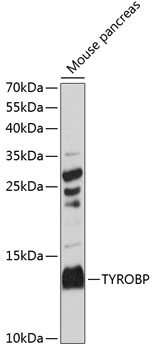 Western blot analysis of extracts of mouse pancreas using TYROBP Polyclonal Antibody at 1:3000 dilution.