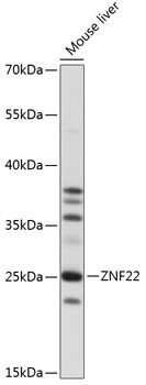 Western blot analysis of extracts of mouse liver using ZNF22 Polyclonal Antibody at 1:1000 dilution.