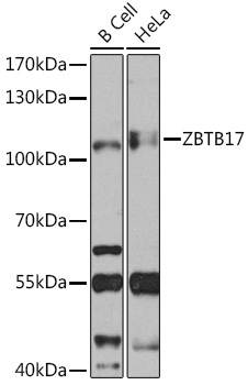 Western blot analysis of extracts of various cell lines using ZBTB17 Polyclonal Antibody at1:1000 dilution.