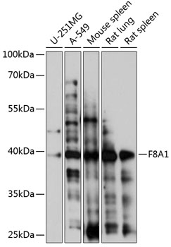 Western blot analysis of extracts of various cell lines using F8A1 Polyclonal Antibody at 1:1000 dilution.