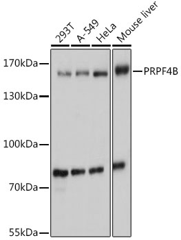 Western blot analysis of extracts of various cell lines using PRPF4B Polyclonal Antibody at 1:1000 dilution.