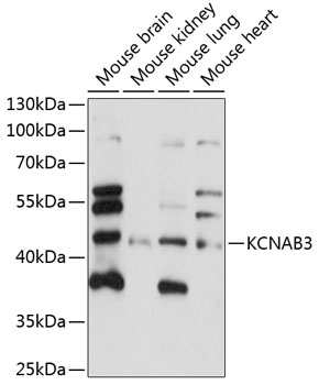 Western blot analysis of extracts of various cell lines using KCNAB3 Polyclonal Antibody at 1:1000 dilution.