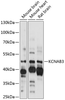 Western blot analysis of extracts of various cell lines using KCNAB3 Polyclonal Antibody at 1:1000 dilution.