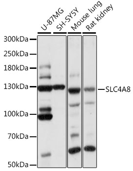 Western blot analysis of extracts of various cell lines using SLC4A8 Polyclonal Antibody at 1:1000 dilution.