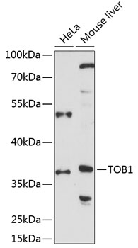 Western blot analysis of extracts of various cell lines using TOB1 Polyclonal Antibody at 1:1000 dilution.