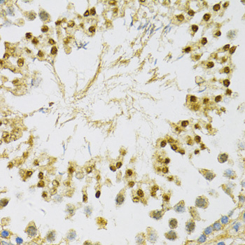 Immunohistochemistry of paraffin-embedded rat testis using SOX30 Polyclonal Antibody at dilution of 1:100 (40x lens).Perform microwave antigen retrieval with 10 mM PBS buffer pH 7.2 before commencing with IHC staining protocol.