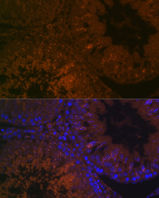 Immunofluorescence analysis of rat testis cells using BACE2 Polyclonal Antibody at dilution of 1:100 (40x lens). Blue: DAPI for nuclear staining.