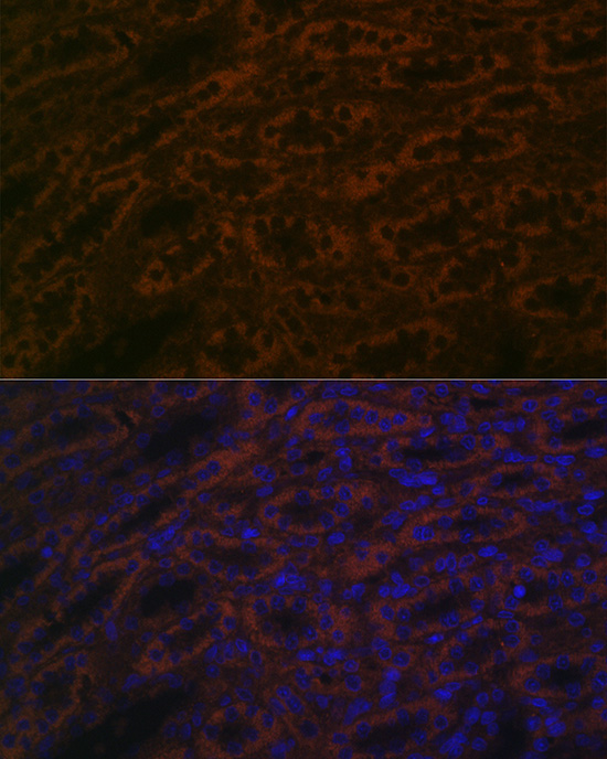 Immunofluorescence analysis of rat kidney cells using BACE2 Polyclonal Antibody at dilution of 1:100 (40x lens). Blue: DAPI for nuclear staining.