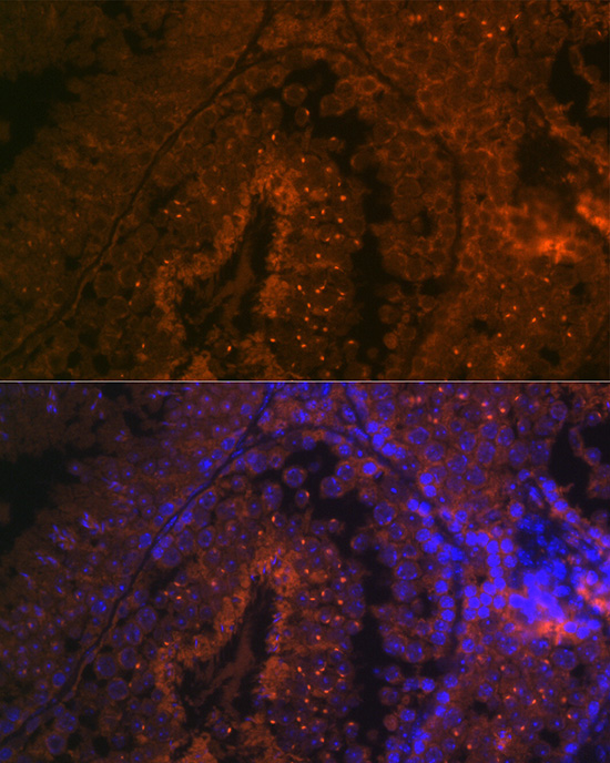 Immunofluorescence analysis of mouse testis cells using BACE2 Polyclonal Antibody at dilution of 1:100 (40x lens). Blue: DAPI for nuclear staining.