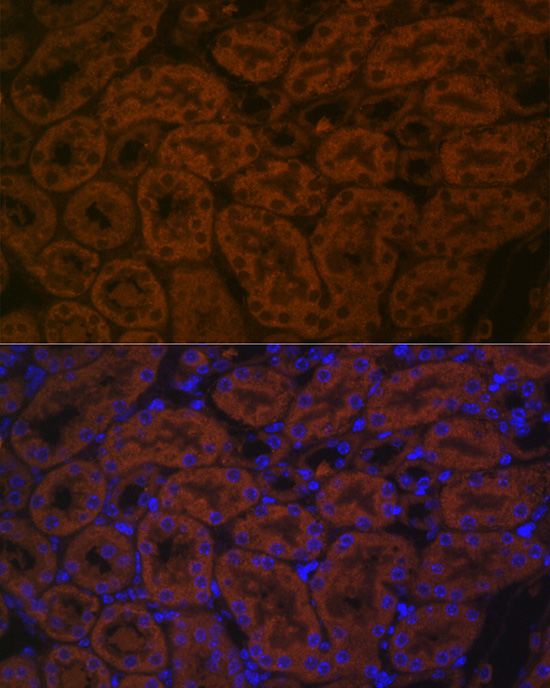 Immunofluorescence analysis of mouse kidney cells using BACE2 Polyclonal Antibody at dilution of 1:100 (40x lens). Blue: DAPI for nuclear staining.