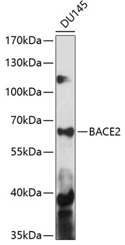 Western blot analysis of extracts of DU145 cells using BACE2 Polyclonal Antibody at 1:1000 dilution.