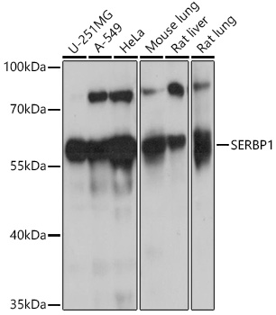 Western blot analysis of extracts of various cell lines using SERBP1 Polyclonal Antibody at 1:1000 dilution.