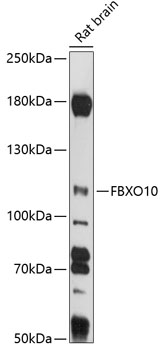 Western blot analysis of extracts of rat brain using FBXO10 Polyclonal Antibody at 1:1000 dilution.