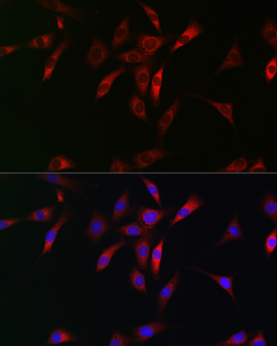 Immunofluorescence analysis of NIH/3T3 cells using NKIRAS1 Polyclonal Antibody at dilution of 1:100 (40x lens). Blue: DAPI for nuclear staining.