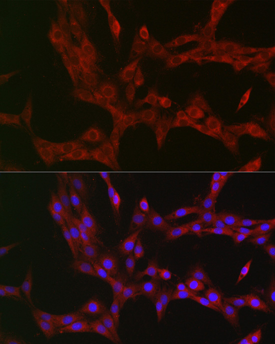 Immunofluorescence analysis of PC-12 cells using NKIRAS1 Polyclonal Antibody at dilution of 1:100 (40x lens). Blue: DAPI for nuclear staining.