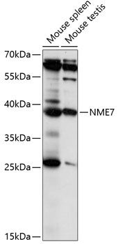 Western blot analysis of extracts of various cell lines using NME7 Polyclonal Antibody at 1:1000 dilution.