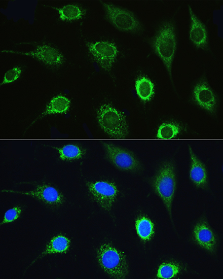 Immunofluorescence analysis of L929 cells using LARS Polyclonal Antibody at dilution of 1:100. Blue: DAPI for nuclear staining.