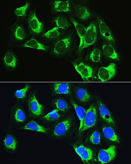 Immunofluorescence analysis of U2OS cells using LARS Polyclonal Antibody at dilution of 1:100. Blue: DAPI for nuclear staining.