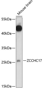 Western blot analysis of extracts of mouse brain using ZCCHC17 Polyclonal Antibody at 1:1000 dilution.