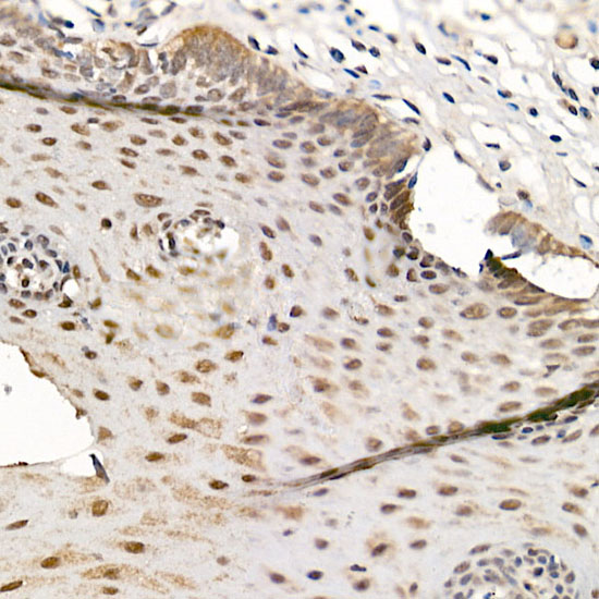 Immunohistochemistry of paraffin-embedded human esophagus using CDK12 Polyclonal Antibody at dilution of 1:500 (40x lens).Perform high pressure antigen retrieval with 10 mM citrate buffer pH 6.0 before commencing with IHC staining protocol.