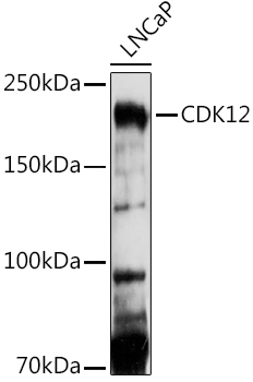 Western blot analysis of extracts of LNCaP cells using CDK12 Polyclonal Antibody at 1:1000 dilution.