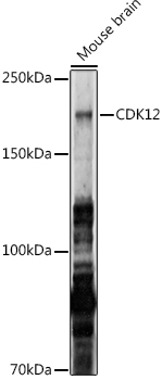 Western blot analysis of extracts of Mouse brain using CDK12 Polyclonal Antibody at 1:1000 dilution.