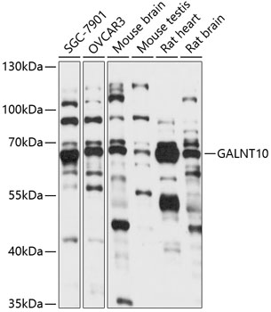 Western blot analysis of extracts of various cell lines using GALNT10 Polyclonal Antibody at 1:1000 dilution.