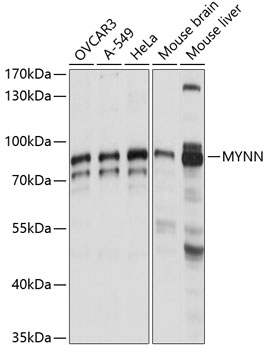 Western blot analysis of extracts of various cell lines using MYNN Polyclonal Antibody at 1:1000 dilution.