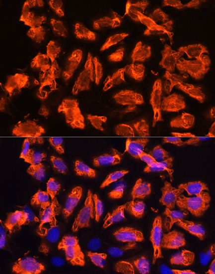 Immunofluorescence analysis of U2OS cells using TCTN1 Polyclonal Antibody at dilution of 1:100. Blue: DAPI for nuclear staining.