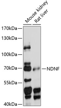 Western blot analysis of extracts of various cell lines using NDNF Polyclonal Antibody at 1:1000 dilution.