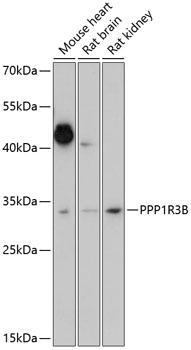 Western blot analysis of extracts of various cell lines using PPP1R3B Polyclonal Antibody at 1:1000 dilution.