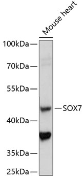 Western blot analysis of extracts of mouse heart using SOX7 Polyclonal Antibody at 1:1000 dilution.