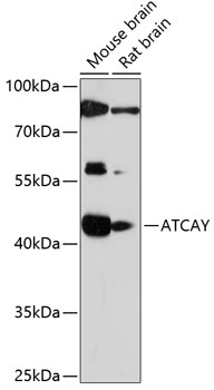 Western blot analysis of extracts of various cell lines using ATCAY Polyclonal Antibody at 1:1000 dilution.