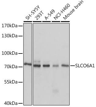 Western blot analysis of extracts of various cell lines using SLCO6A1 Polyclonal Antibody at1:1000 dilution.