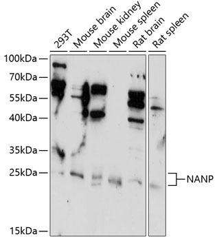 Western blot analysis of extracts of various cell lines using NANP Polyclonal Antibody at 1:1000 dilution.