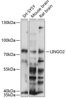 Western blot analysis of extracts of various cell lines using LINGO2 Polyclonal Antibody at 1:1000 dilution.