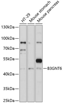 Western blot analysis of extracts of various cell lines using B3GNT6 Polyclonal Antibody at 1:1000 dilution.