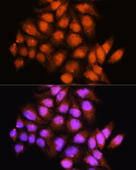 Immunofluorescence analysis of HeLa cells using ADK Polyclonal Antibody at dilution of 1:100. Blue: DAPI for nuclear staining.