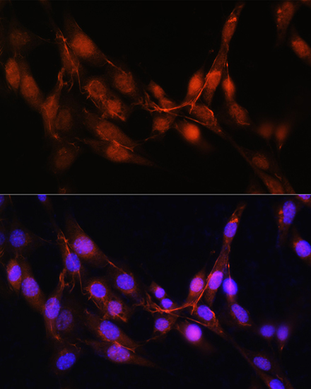 Immunofluorescence analysis of NIH/3T3 cells using ADK Polyclonal Antibody at dilution of 1:100. Blue: DAPI for nuclear staining.