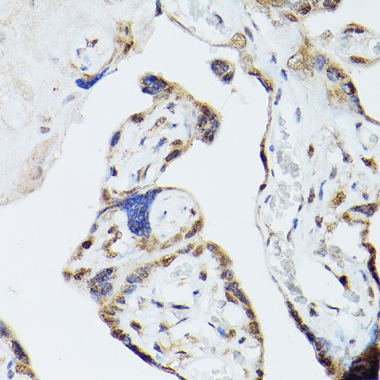 Immunohistochemistry of paraffin-embedded human placenta using ADK Polyclonal Antibody at dilution of 1:300 (40x lens).Perform high pressure antigen retrieval with 10 mM citrate buffer pH 6.0 before commencing with IHC staining protocol.