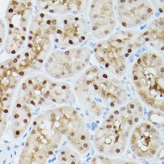 Immunohistochemistry of paraffin-embedded mouse kidney using ADK Polyclonal Antibody at dilution of 1:300 (40x lens).Perform high pressure antigen retrieval with 10 mM citrate buffer pH 6.0 before commencing with IHC staining protocol.