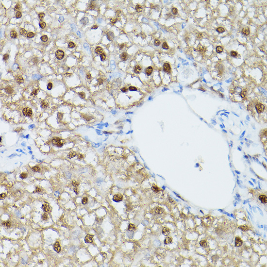 Immunohistochemistry of paraffin-embedded rat liver using ADK Polyclonal Antibody at dilution of 1:300 (40x lens).Perform high pressure antigen retrieval with 10 mM citrate buffer pH 6.0 before commencing with IHC staining protocol.