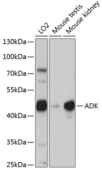 Western blot analysis of extracts of various cell lines using ADK Polyclonal Antibody at 1:1000 dilution.