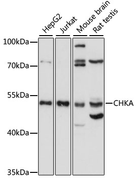 Western blot analysis of extracts of various cell lines using CHKA Polyclonal Antibody at 1:1000 dilution.