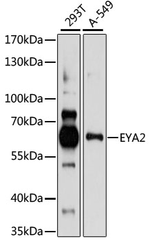 Western blot analysis of extracts of various cell lines using EYA2 Polyclonal Antibody at 1:1000 dilution.