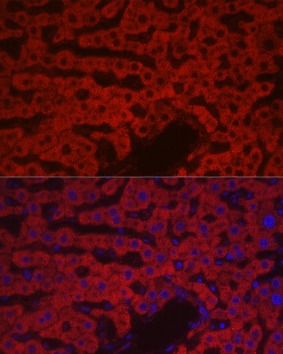 Immunofluorescence analysis of rat liver cells using F10 Polyclonal Antibody at dilution of 1:100 (40x lens). Blue: DAPI for nuclear staining.