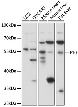 Western blot analysis of extracts of various cell lines using F10 Polyclonal Antibody at 1:1000 dilution.