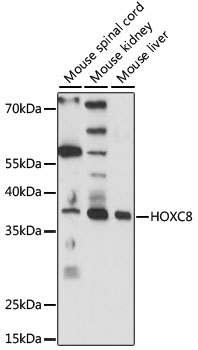 Western blot analysis of extracts of various cell lines using HOXC8 Polyclonal Antibody at 1:1000 dilution.